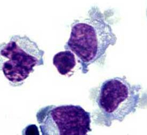 Natrual Killer Cells Image
