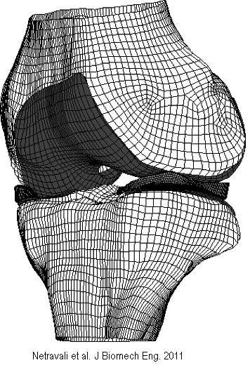 Finite element model of a knee