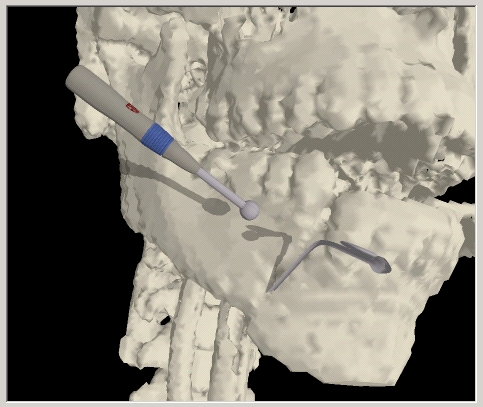 image of craniofacial surgical simulation