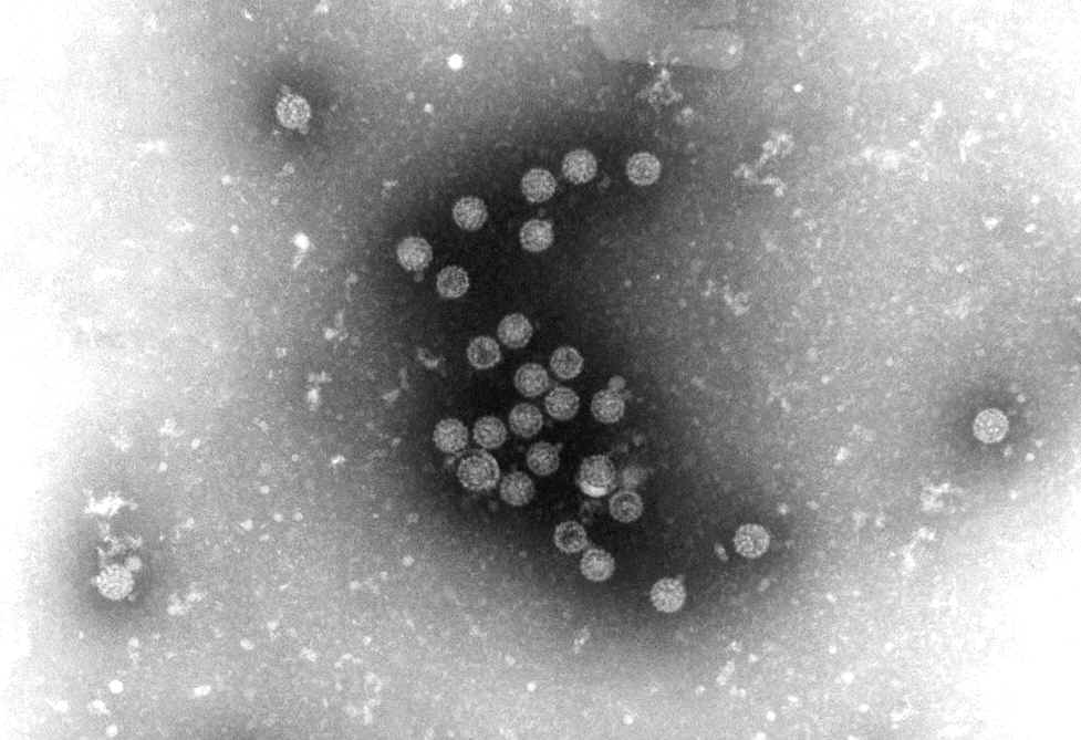 Image of Simian Virus 40